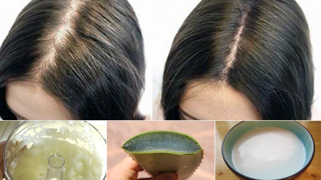 what to use for thinning hair quickly